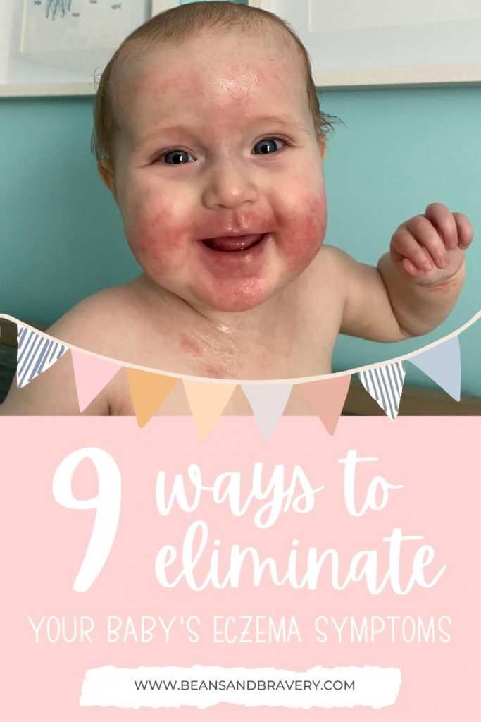 baby with eczema